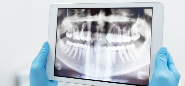 l'examen complet: une approche globale de votre dentition